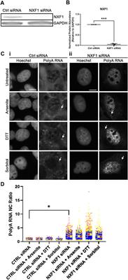 Polyadenylated RNA and RNA-Binding Proteins Exhibit Unique Response to Hyperosmotic Stress